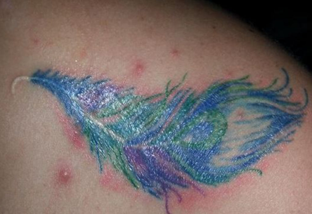 Will Pimples Damage New Tattoos?
